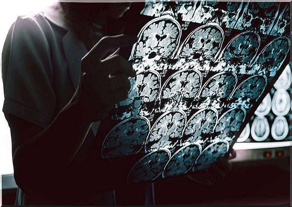 Brain x-ray