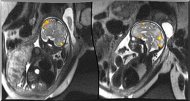 Never-before-seen images of human fetus brain activity.