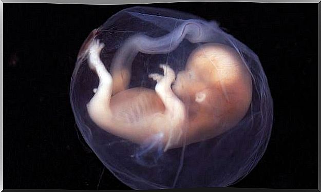 Picture of a fetus